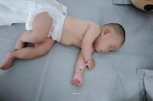 桂林宝宝头上长痱子